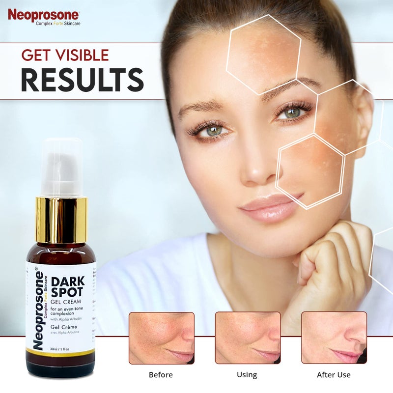 Neoprosone, Dark Spot Remover for Face - 1 Fl oz / 30 ml - Brightening Cream, Reduce Blemishes, Sun Spots, Brown Spots on: Face, Knees, Elbows, Hands, Private Areas - Image 3